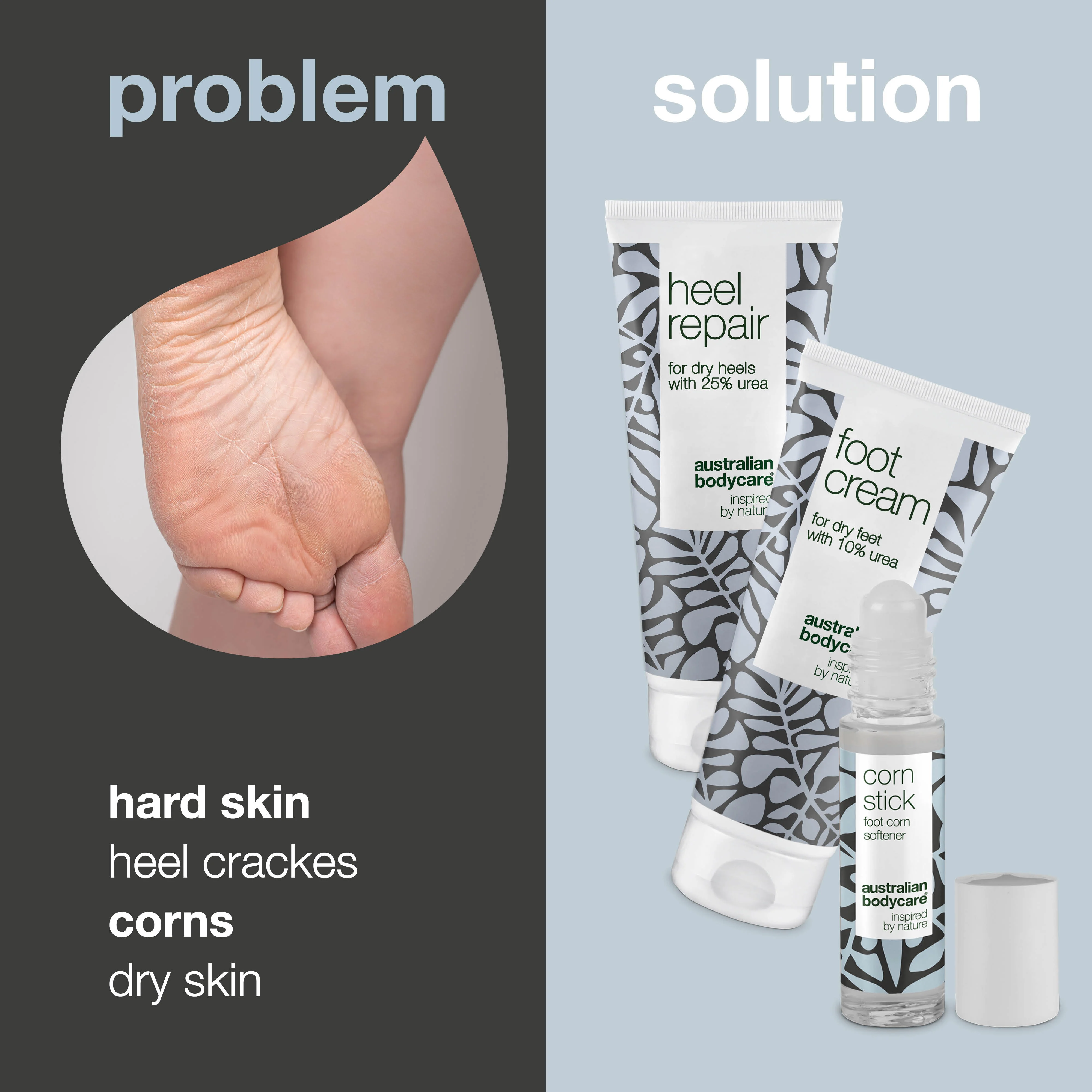 3 Products for calluses and corn on foot — Foot cream, heel cream and corn oil for dry feet. - Image 2