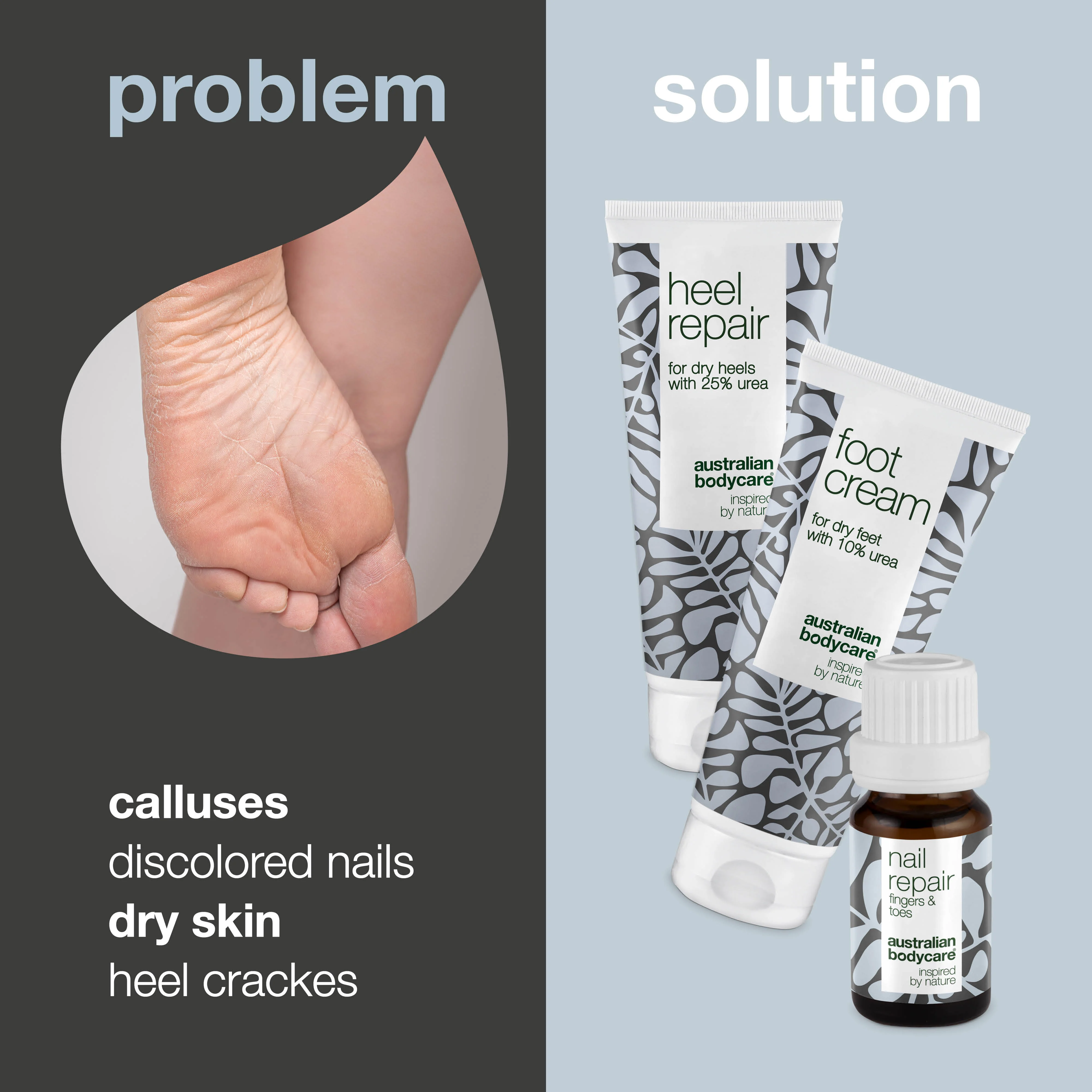 Foot and nail kit — for callus and discoloured nails - Image 3