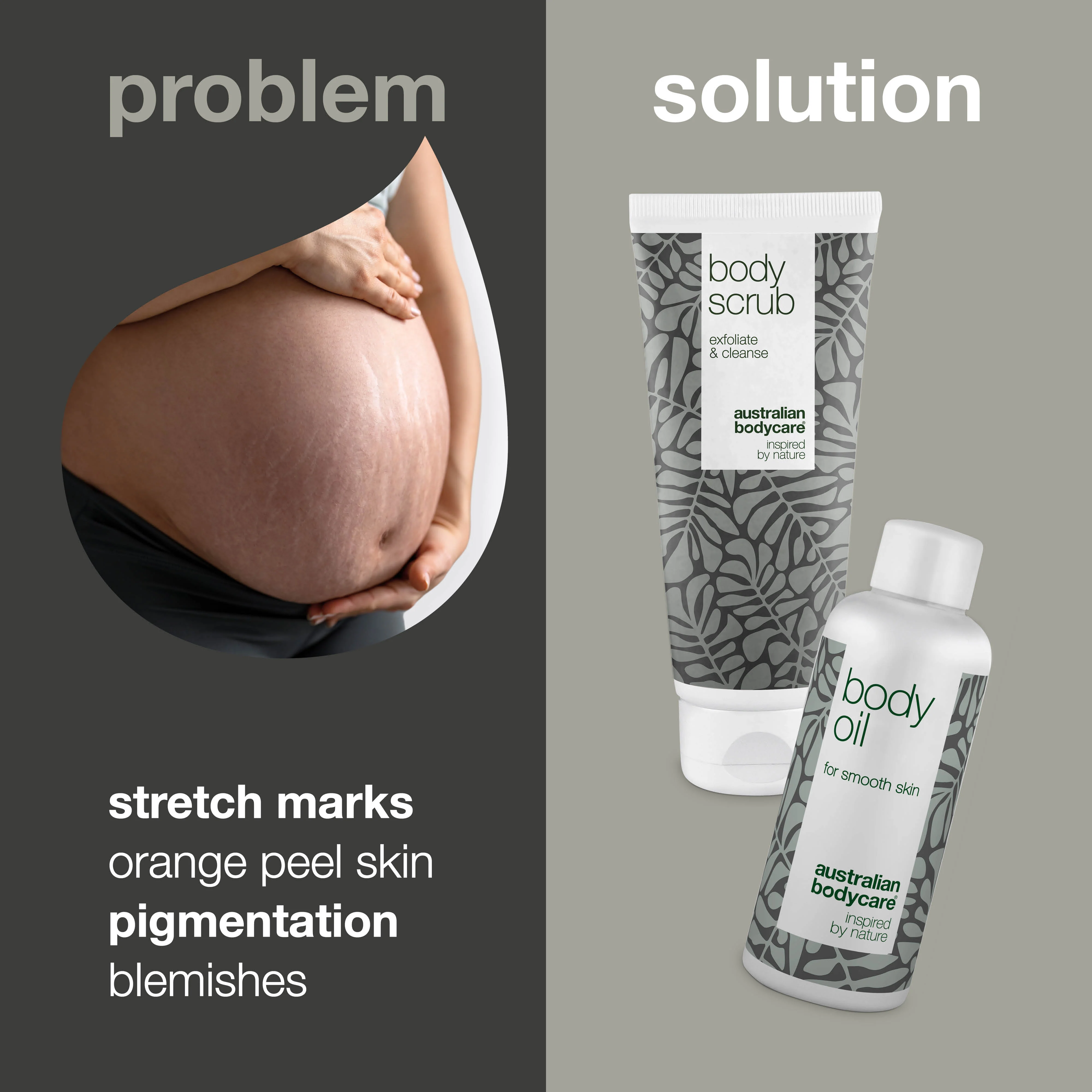 Pregnancy package for the pregnant woman with 2 products — Reduces the visibility of stretch marks and is used for the care of orange peel skin - Image 2